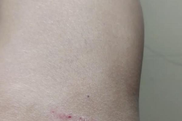 女人梦见狗咬是什么预兆 女人梦见狗咬是什么预兆