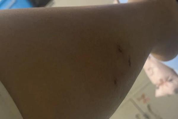 梦到被猫咬 梦到被猫咬