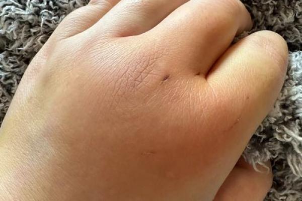 梦见被猫咬了是什么意思