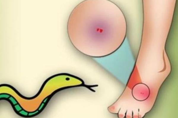 梦见被蛇咬是什么预兆 梦见被蛇咬是什么预兆