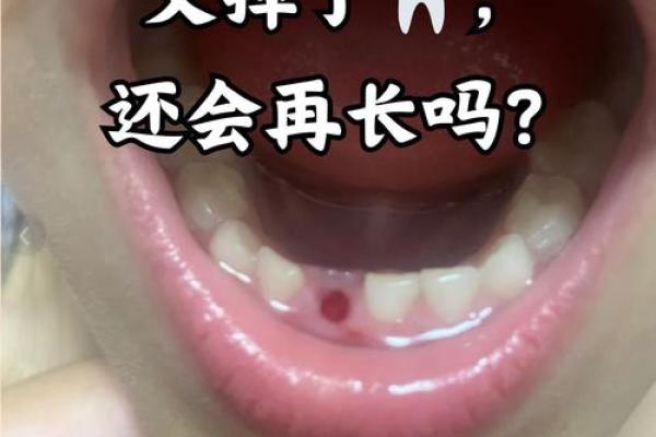 男人梦到全口牙掉光了 男人梦到全口牙掉光了