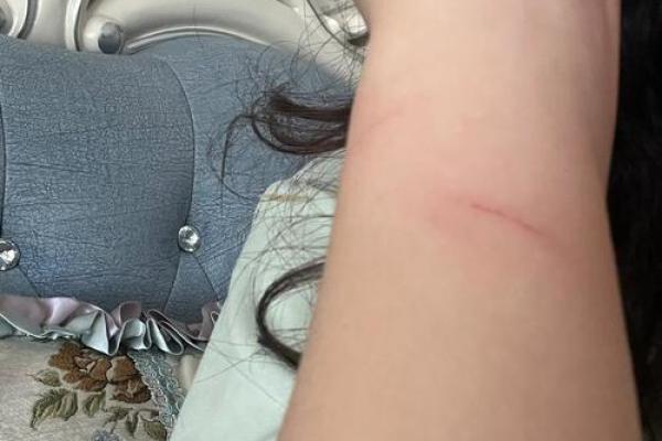 女人梦到被猫抓伤手 女人梦到被猫抓伤手